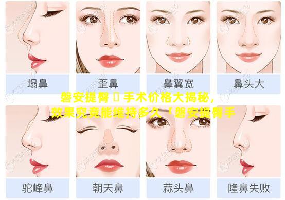 磐安提臀 ☘ 手术价格大揭秘，效果究竟能维持多久「磐安提臀手术价格大揭秘,效果究竟能维持多久」